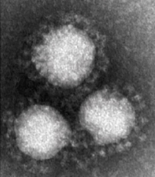新型コロナウイルス（SARS-CoV-2）