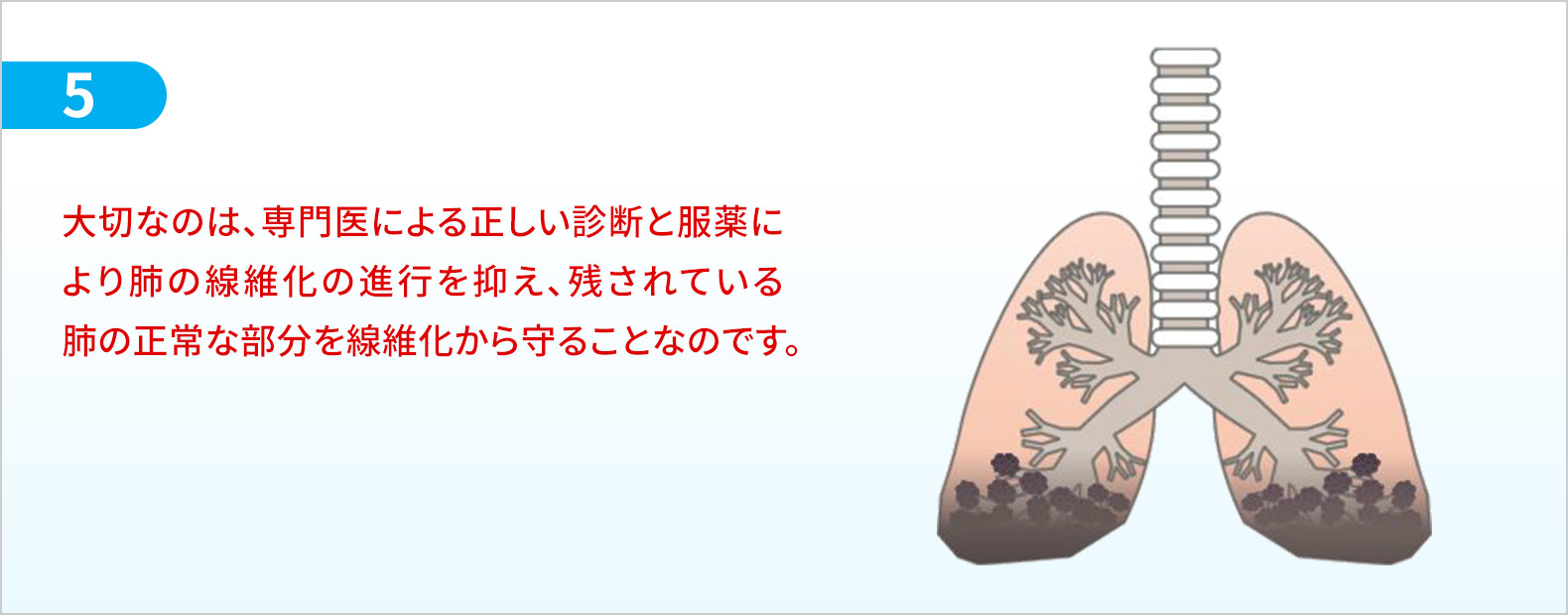 大切なのは、専門医による正しい診断と服薬により肺の線維化の進行を抑え、残されている肺の正常な部分を線維化から守ることなのです。