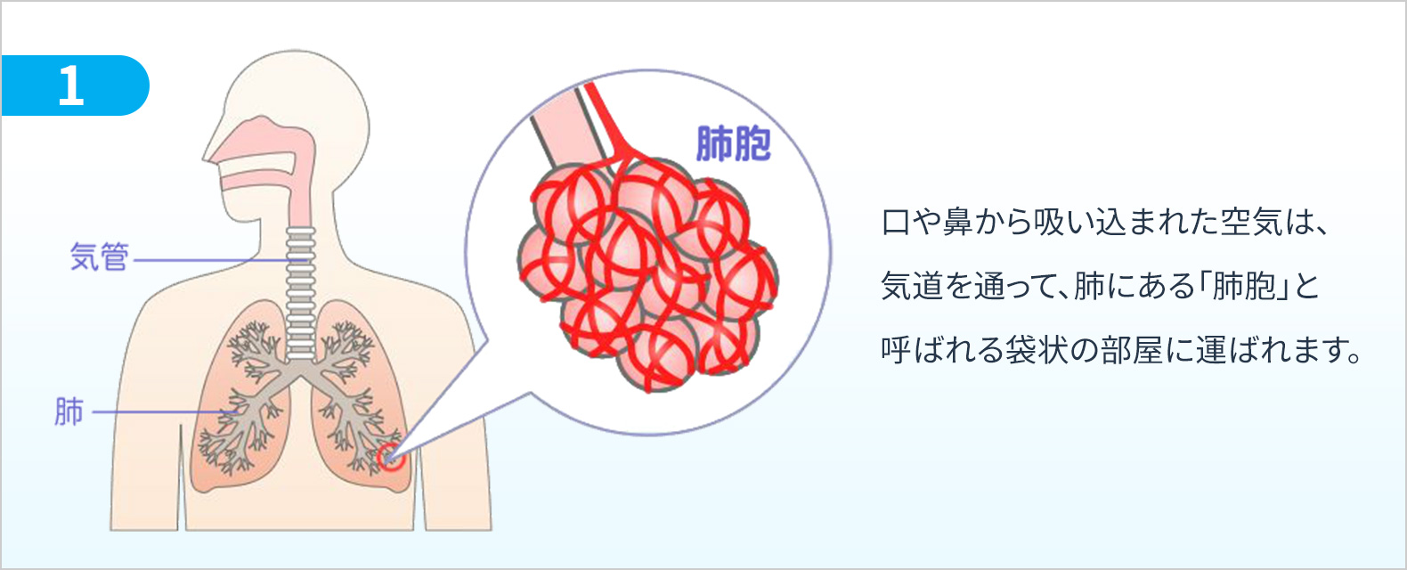 肺について 肺の働きと特発性肺線維症 Ipf 患者さんの肺の変化 特発性肺線維症 Ipf について シオノギ製薬 塩野義製薬